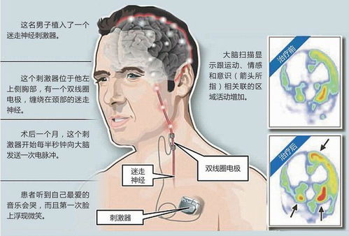 植物与人类的异同